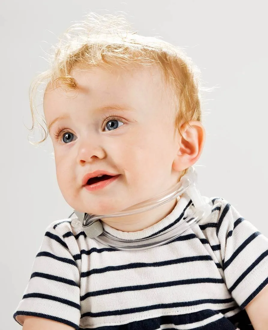 The TOT Collar - for Effective Management of Congenital Muscular Torticollis
