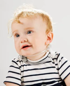 The TOT Collar - for Effective Management of Congenital Muscular Torticollis